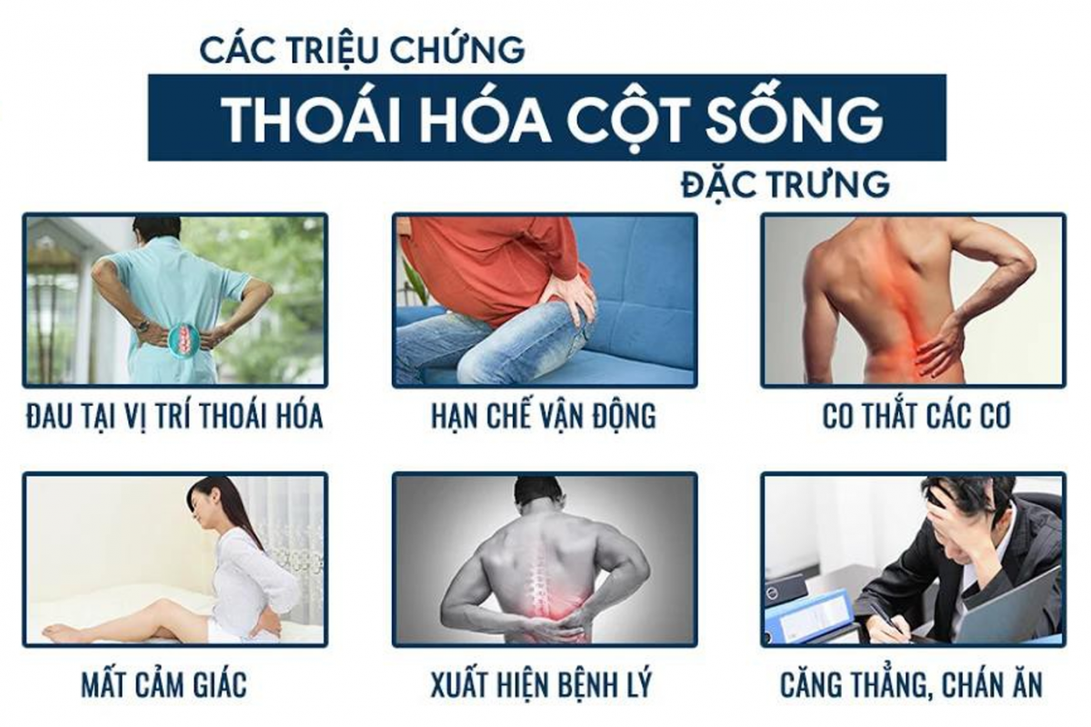 Thoái hóa cột sống thắt lưng