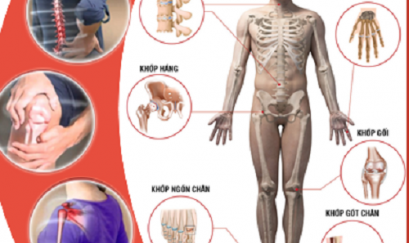 Dấu hiệu của bệnh viêm khớp